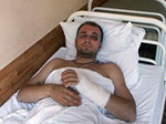 Чемальские медики спасли мужчину, отпилившего руку циркуляркой