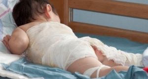 Мужчину будут судить за то, что он ошпарил сына кипятком в бане