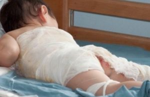 Мужчину будут судить за то, что он ошпарил сына кипятком в бане