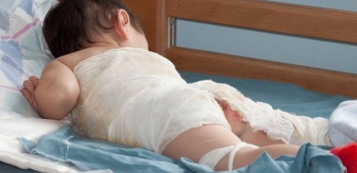 Мужчину будут судить за то, что он ошпарил сына кипятком в бане