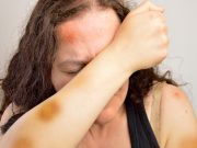 19-летний парень жестоко избил мать и отчима