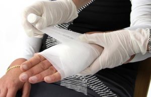 Свекор сломал невестке руку черенком лопаты