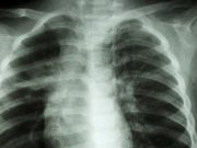 Житель Горного Алтая изувечил пьяного родственника, пытаясь привести его в чувство