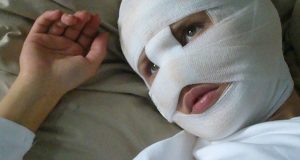 Преступник, обезобразивший женщине лицо, выплатит своей жертве компенсацию