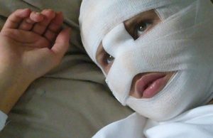 Преступник, обезобразивший женщине лицо, выплатит своей жертве компенсацию