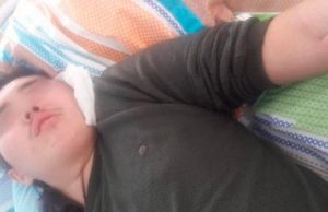 «Его пинали и били, но никто не остановил это зверство». В Акташе избили подростка-инвалида
