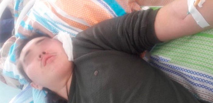 «Его пинали и били, но никто не остановил это зверство». В Акташе избили подростка-инвалида
