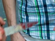28-летняя женщина в порыве ревности ударила мужа ножом в живот
