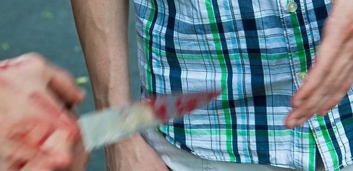 28-летняя женщина в порыве ревности ударила мужа ножом в живот