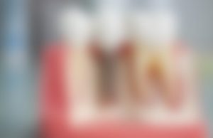 Установка имплантов в Калининграде