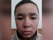 На Алтае разыскивают подростка, сбежавшего из больницы На Алтае разыскивают подростка, сбежавшего из больницы
