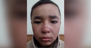 На Алтае разыскивают подростка, сбежавшего из больницы На Алтае разыскивают подростка, сбежавшего из больницы