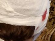 20-летний парень откусил ухо девушке, которая решила с ним расстаться 20-летний парень откусил ухо девушке, которая решила с ним расстаться