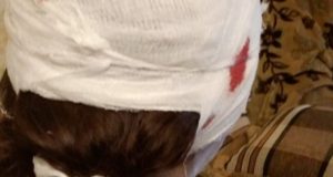 20-летний парень откусил ухо девушке, которая решила с ним расстаться 20-летний парень откусил ухо девушке, которая решила с ним расстаться