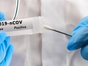 15 новых случаев заражения коронавирусом за сутки зарегистрировано на Алтае
