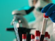 17 случаев заражения коронавирусом выявлено за сутки в Республике Алтай