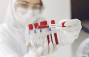 11 новых случаев заражения коронавирусом выявлено в Горном Алтае 11 новых случаев заражения коронавирусом выявлено в Горном Алтае