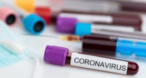 Восемь новых случаев заражения коронавирусом за сутки выявили в Республике Алтай