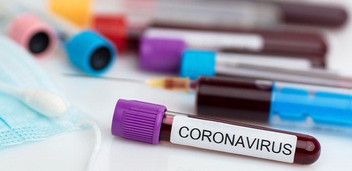 Восемь новых случаев заражения коронавирусом за сутки выявили в Республике Алтай