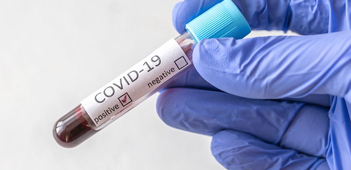21 случай заражения коронавирусом выявлен на Алтае за сутки