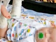 Женщина с младенцем на руках упала на ступеньках магазина, малыш сломал ногу Женщина с младенцем на руках упала на ступеньках магазина, малыш сломал ногу