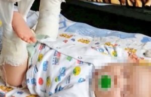 Женщина с младенцем на руках упала на ступеньках магазина, малыш сломал ногу Женщина с младенцем на руках упала на ступеньках магазина, малыш сломал ногу