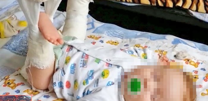 Женщина с младенцем на руках упала на ступеньках магазина, малыш сломал ногу