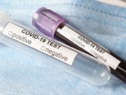 За сутки выявлено 26 новых случаев заражения коронавирусом За сутки выявлено 26 новых случаев заражения коронавирусом