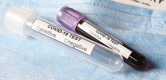 За сутки выявлено 26 новых случаев заражения коронавирусом