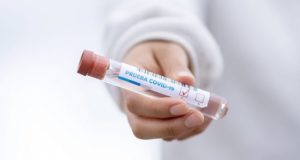 За сутки в республике выявлено 23 случая заражения коронавирусом