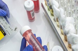Семь новых случаев заражения коронавирусом выявили за сутки на Алтае Семь новых случаев заражения коронавирусом выявили за сутки на Алтае