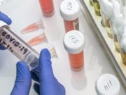 Коронавирус: за сутки выявлено 22 случая заражения Коронавирус: за сутки выявлено 22 случая заражения