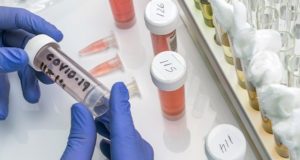 Коронавирус: за сутки выявлено 22 случая заражения