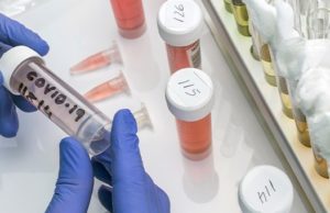 Коронавирус: за сутки выявлено 22 случая заражения Коронавирус: за сутки выявлено 22 случая заражения