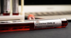 За сутки на Алтае выявлен 21 случай заражения коронавирусом