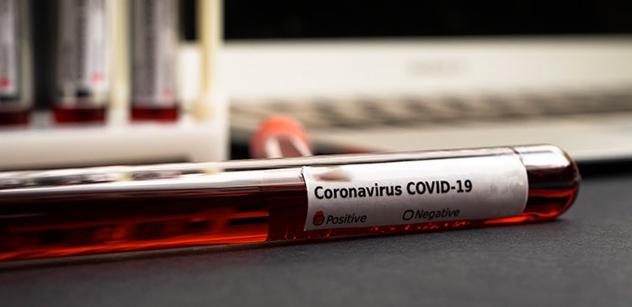 За сутки на Алтае выявлен 21 случай заражения коронавирусом