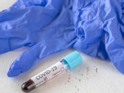 Коронавирус: семь новых случаев, восемь выздоровевших Коронавирус: семь новых случаев, восемь выздоровевших
