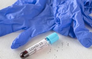 Коронавирус: семь новых случаев, восемь выздоровевших Коронавирус: семь новых случаев, восемь выздоровевших