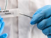 Коронавирус подтвердился еще у 37 человек Коронавирус подтвердился еще у 37 человек