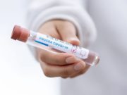 Коронавирус: 52 новых случая за сутки Коронавирус: 52 новых случая за сутки