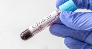 36 случаев заражения коронавирусом выявлено на Алтае за сутки