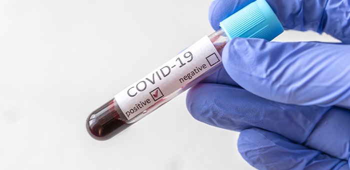36 случаев заражения коронавирусом выявлено на Алтае за сутки