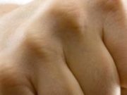 «Знакомство с родителями» закончилось открытым переломом носа