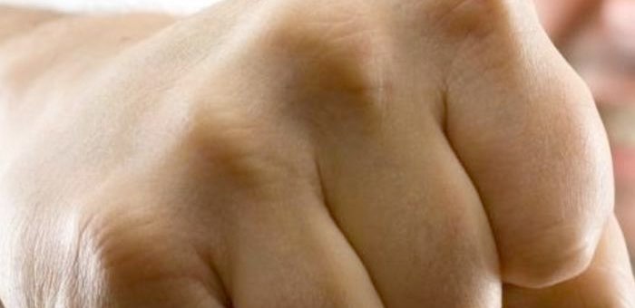 «Знакомство с родителями» закончилось открытым переломом носа