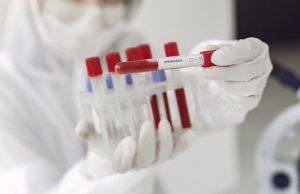 За сутки выявлено 163 случая заражения коронавирусом За сутки выявлено 163 случая заражения коронавирусом