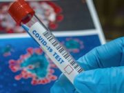 За сутки выявлен 61 случай заражения коронавирусом За сутки выявлен 61 случай заражения коронавирусом