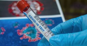 За сутки выявлен 61 случай заражения коронавирусом