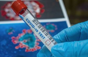 За сутки выявлен 61 случай заражения коронавирусом За сутки выявлен 61 случай заражения коронавирусом