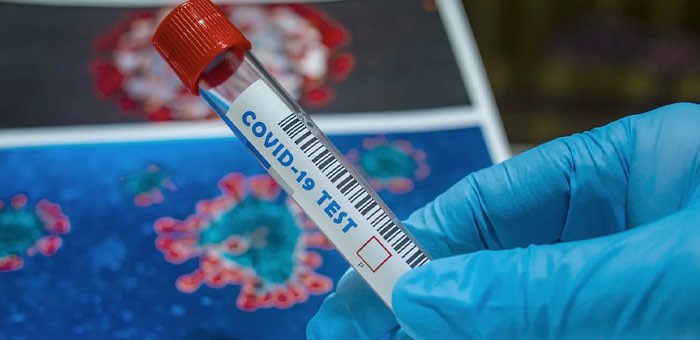 За сутки выявлен 61 случай заражения коронавирусом
