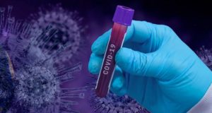 63 случая заражения коронавирусом выявлено за сутки на Алтае